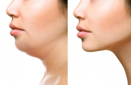 7+ cách giảm béo gò má không cần tập luyện vất vả